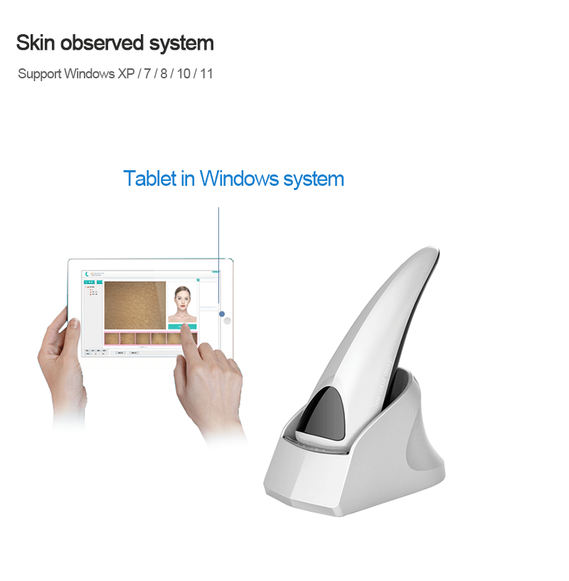 Skin analysis observed system portable equipment - News - 1