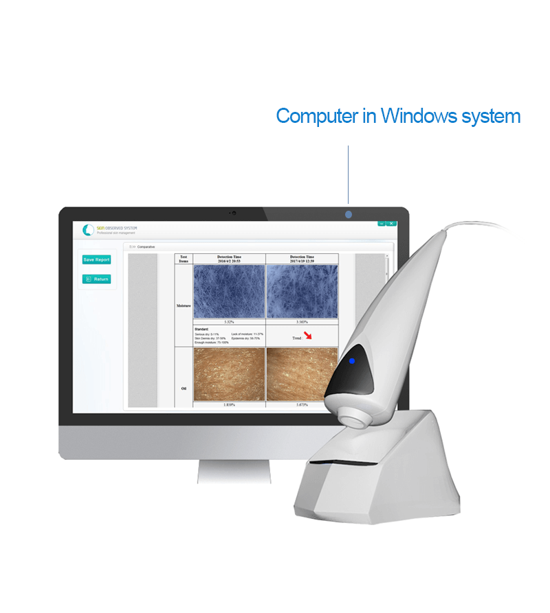 Skin analysis observed system portable equipment - News - 3