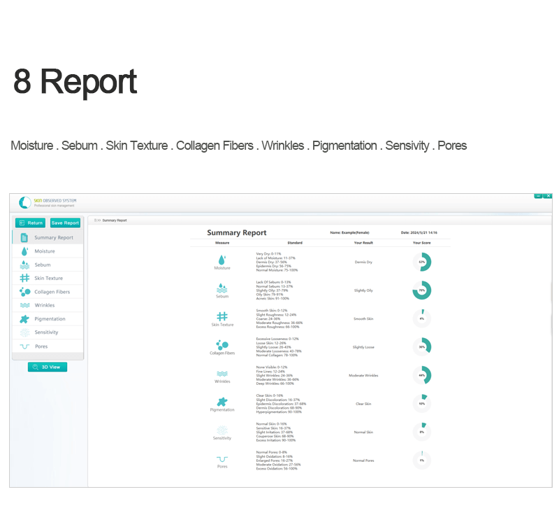 Skin analysis observed system portable equipment - News - 6