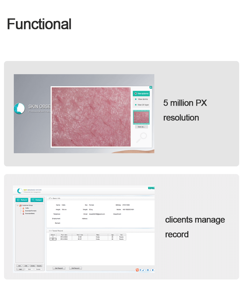 Skin analysis observed system portable equipment - News - 8