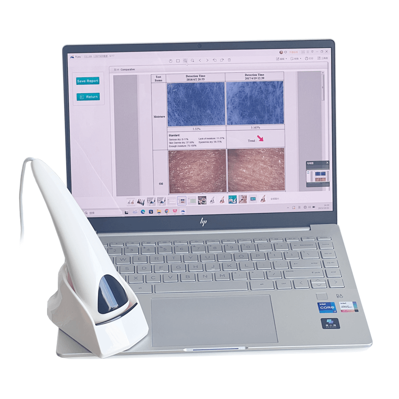 Italian skin analysis machine - News - 3