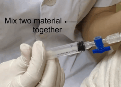 Hyaluronic acid serum for microneedling pen