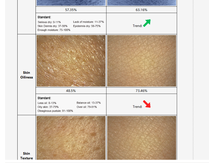 skin and quantum analyzer two in 1 -  - 3