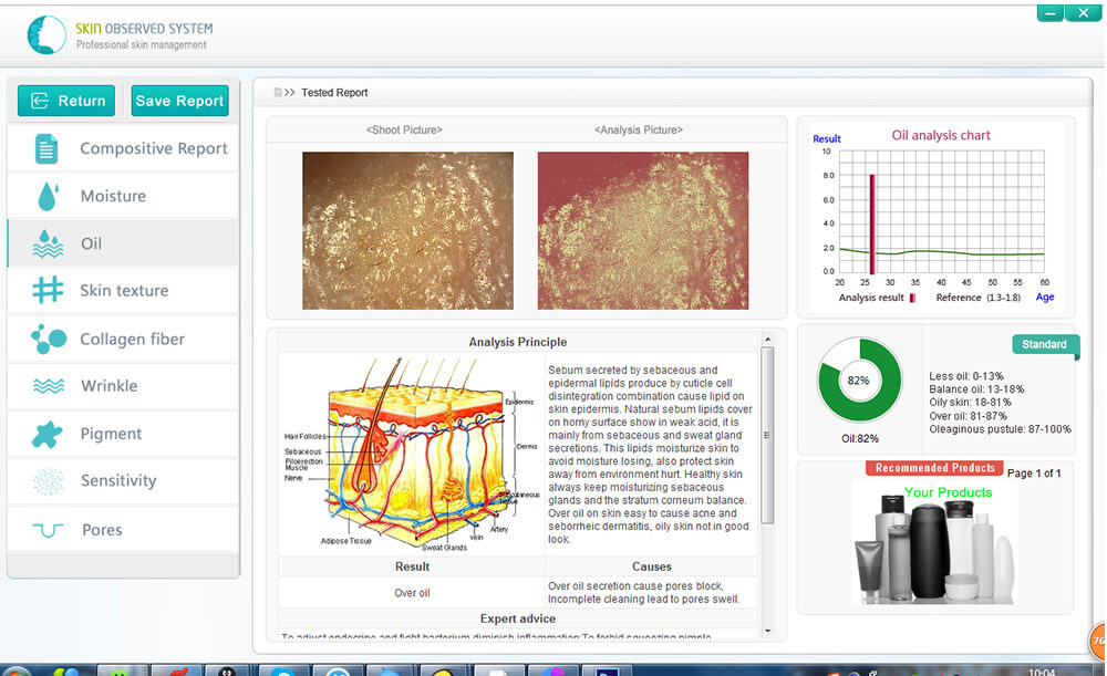 USB skin analyzer - News - 2