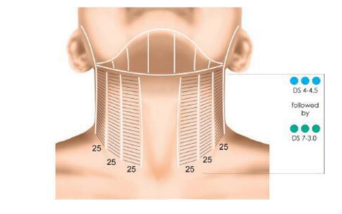 Viginal HIFU and 5D facial HIFU machine for tighten and lifting -  - 8