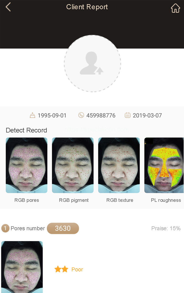 skin analyzer M9 accuracy basic on high setting hardware - News - 3