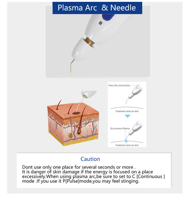 Plamere pen plasma lift -  - 8