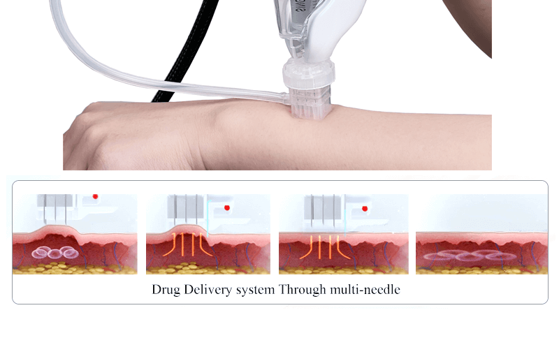 mesotherapy gun