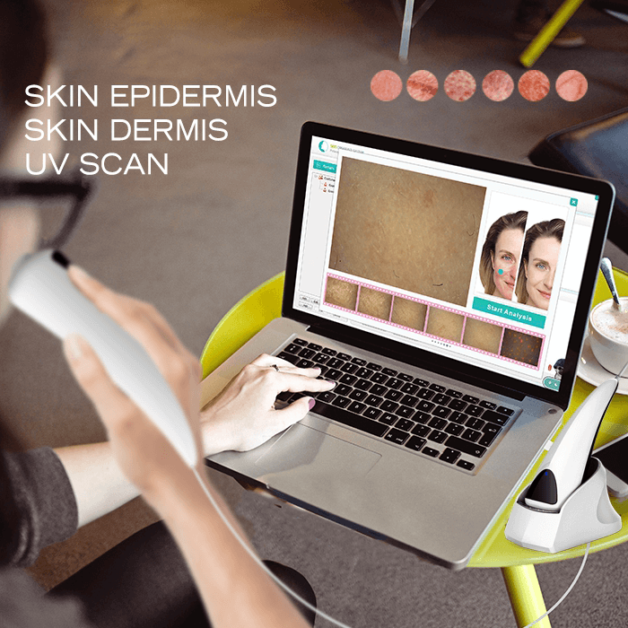 USB skin analysis for beauty store chains - News - 1