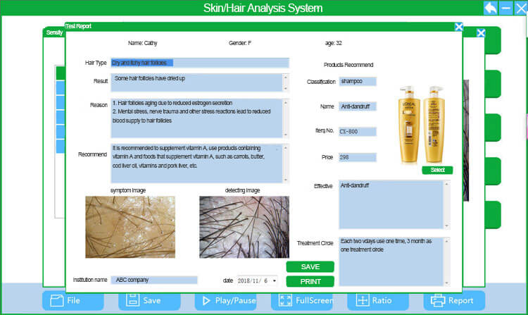 USB connection phone and computer connection hair scalp analysis -  - 9