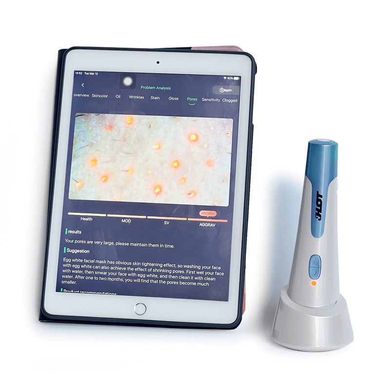 Skin and hair analysis machine for Phone, iPad and computer - News - 6