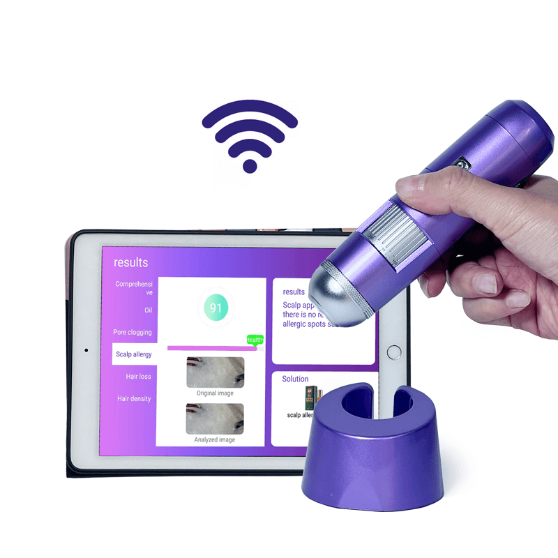 scalp analyzer for API makeup mirror - News - 1