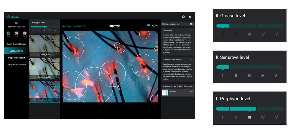 AI hair scalp analyzer giving report and recommendation -  - 2
